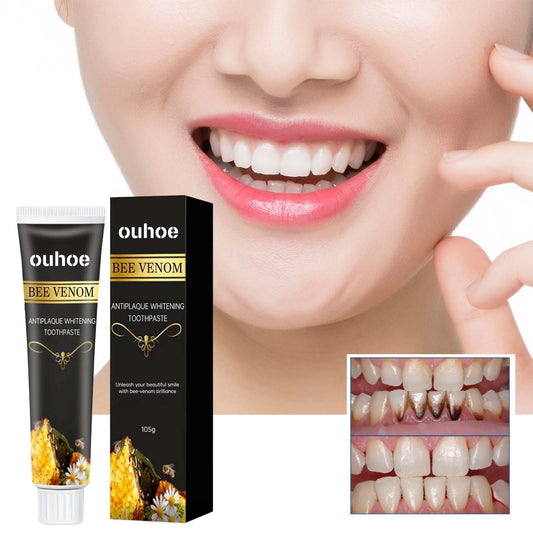 Tartar & Stain Removal Toothpaste – Fresh Breath & Healthy Gums!