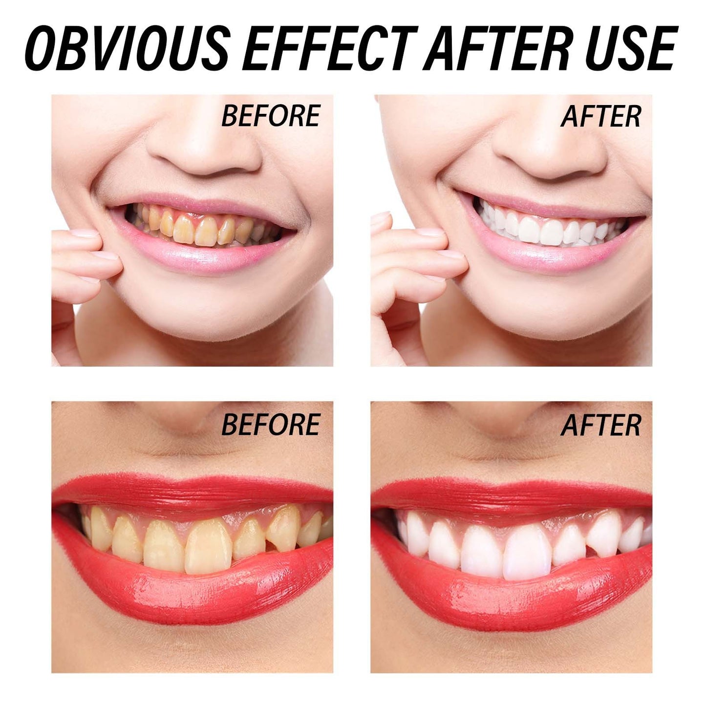 Tartar & Stain Removal Toothpaste – Fresh Breath & Healthy Gums!