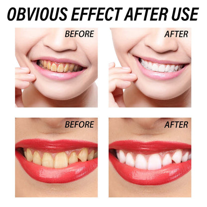 Tartar & Stain Removal Toothpaste – Fresh Breath & Healthy Gums!