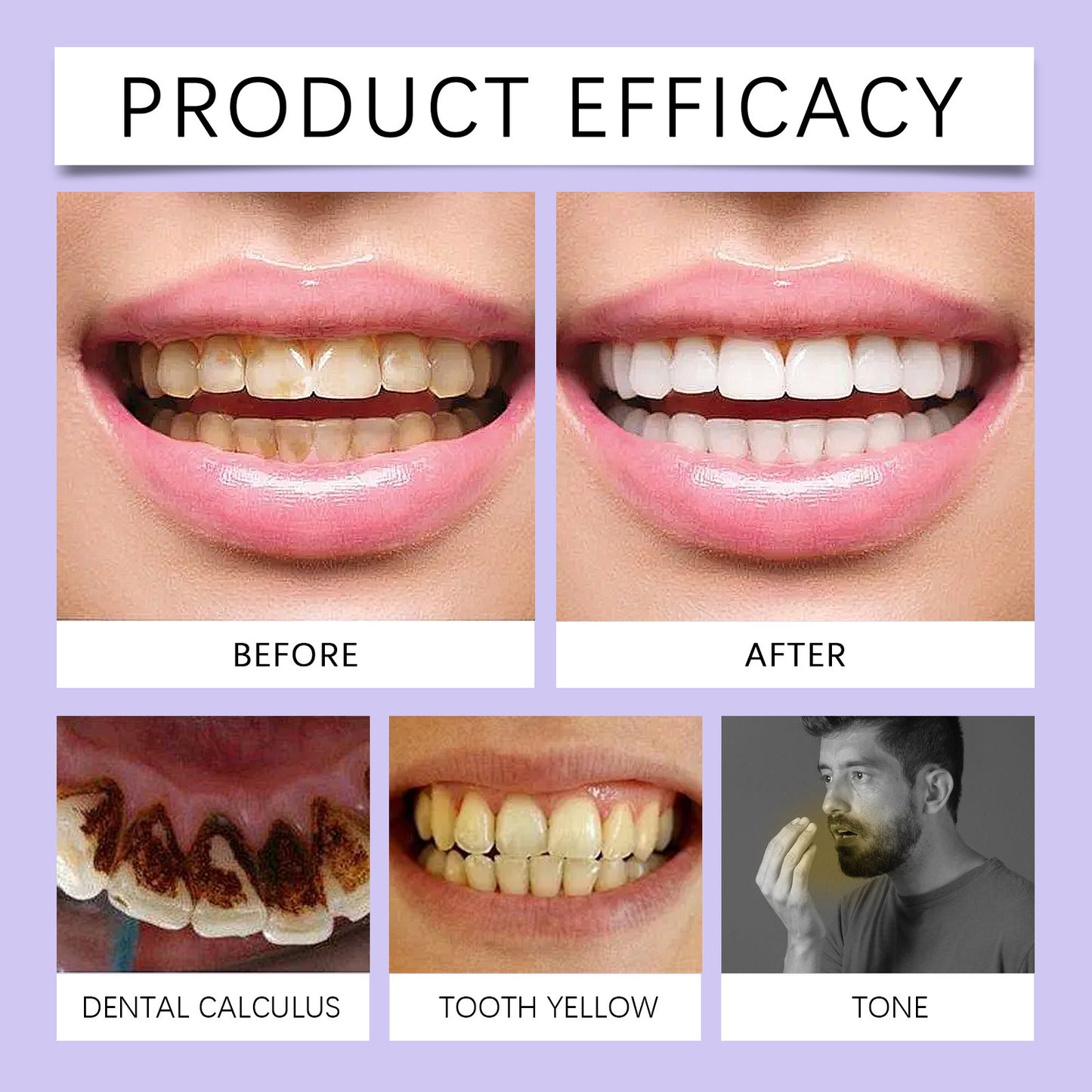 Purple Teeth Whitening Toothpaste – Gentle Care for a Brighter Smile!