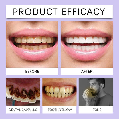 Purple Teeth Whitening Toothpaste – Gentle Care for a Brighter Smile!