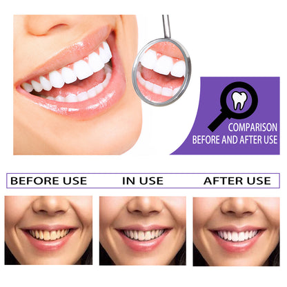 Teeth Whitening Toothpaste – Instantly Brighten Your Smile!