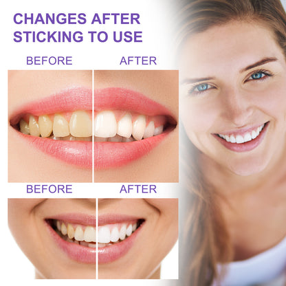 Teeth Whitening Toothpaste – Instantly Brighten Your Smile!
