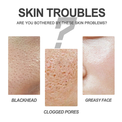 PorePure Blackhead Removal Cream