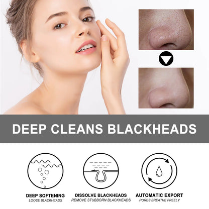 PorePure Blackhead Removal Cream